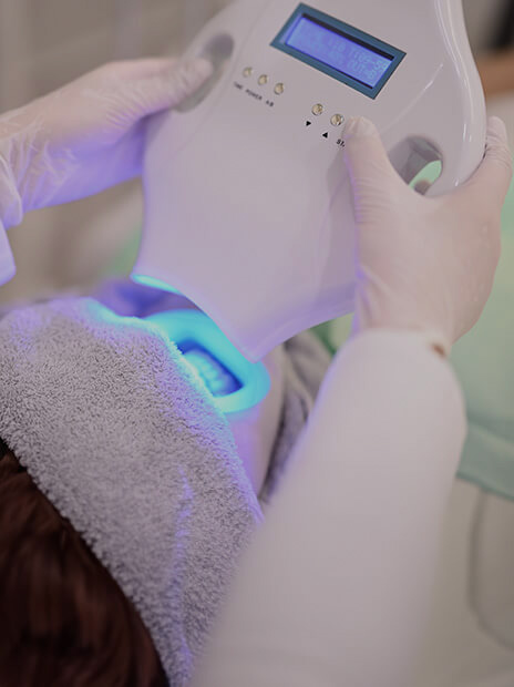 ホワイトニング